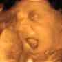 ecografias 4d, centro de imagen 4d prenatal ecomamá 4d